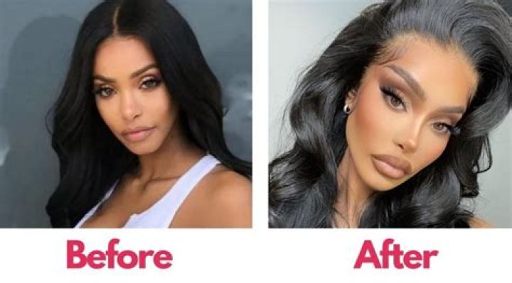 Model Yodit Yemane Plastic Surgery, Before And After Pics Age And Instagram